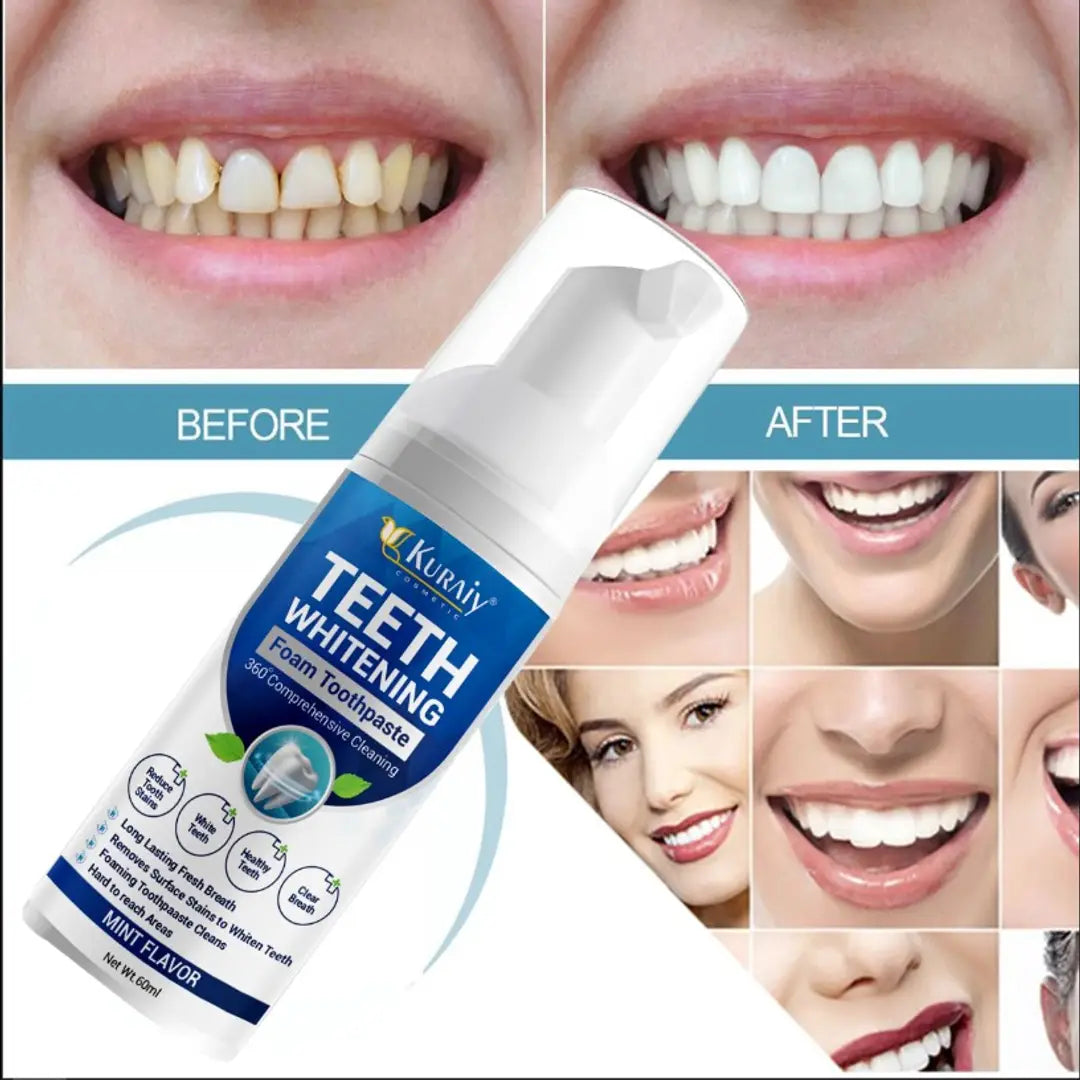 TEETH WHITENING FOAM (BUY 1 GET 1 FREE)