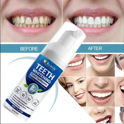TEETH WHITENING FOAM (BUY 1 GET 1 FREE)