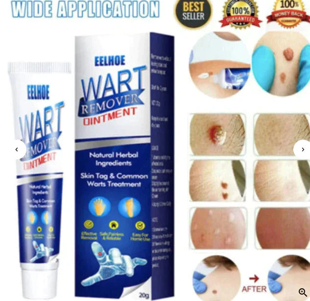 Instant Wart Removal Cream - 100g [ BUY 1 GET 1 FREE]