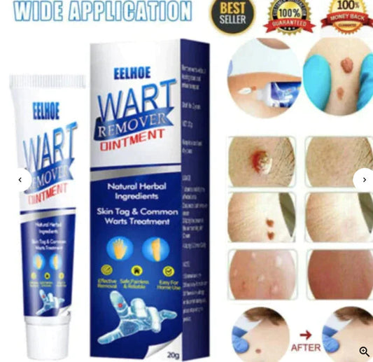 Instant Wart Removal Cream - 100g [ BUY 1 GET 1 FREE]